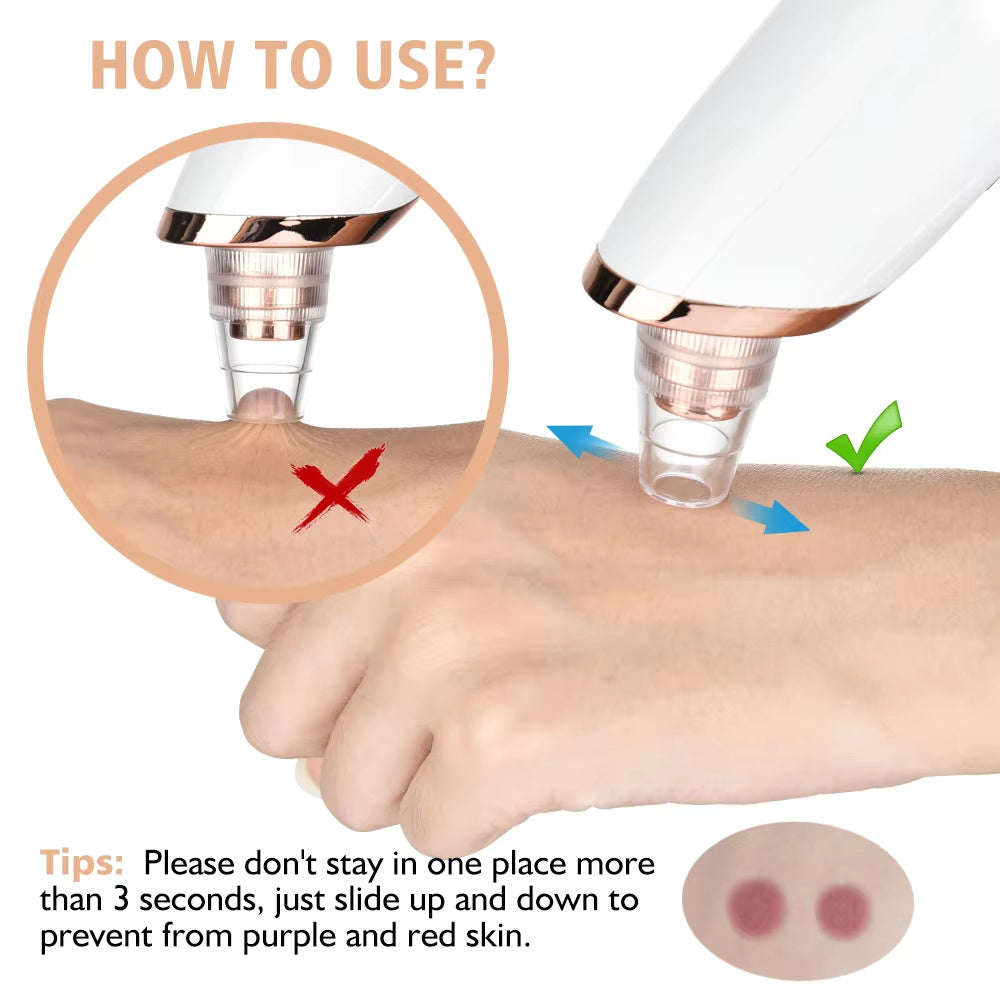 Facial Pore Vacuum